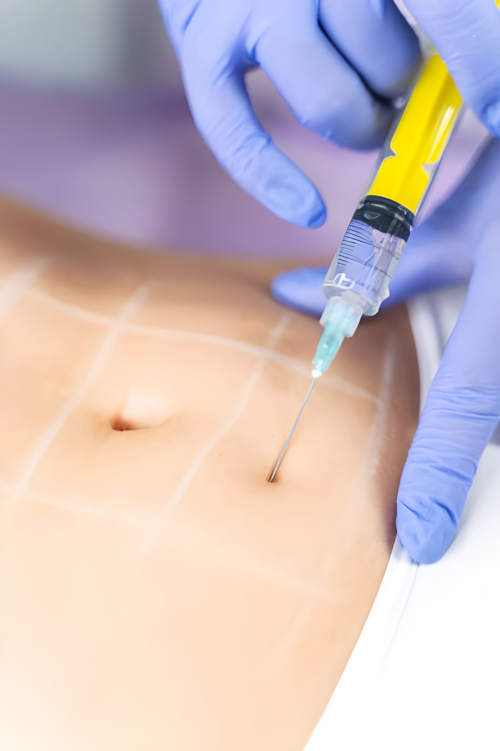 Non surgical fat reduction injections in Islamabad Rawalpindi